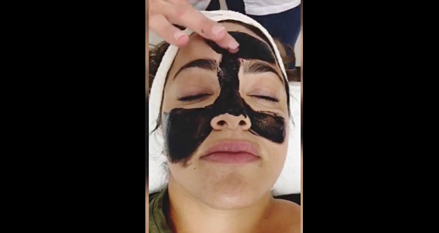 facial carbon activado en guadalajara